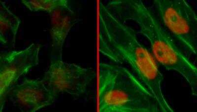 Immunocytochemistry/ Immunofluorescence: RPA2 [p Ser4, p Ser8] Antibody [NBP1-23017]